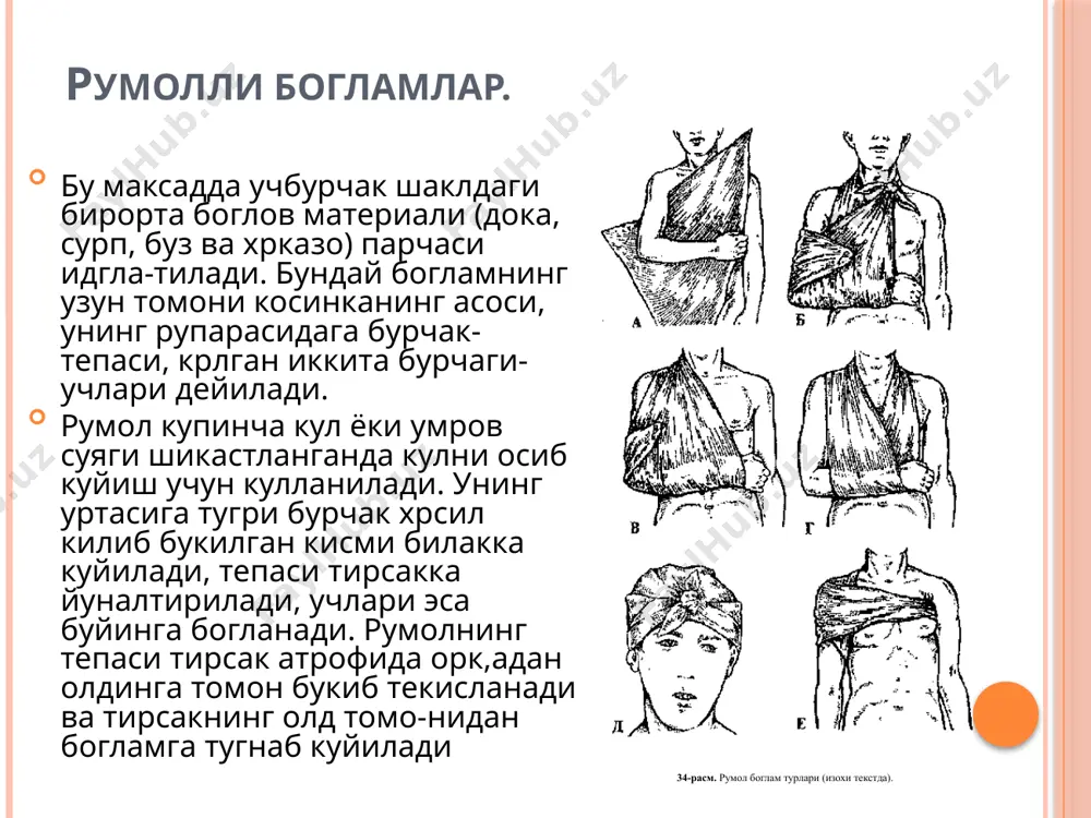 hlab kuyi­ladi. boglam kukrak kdfasining pastki kdsmidan, bintning shu bulagini berkitishdan boshlanadi. bintning spiral uramlari asta-sekin to kultikdacha etkazib uraladi va oxirgi urami bilan max,-kamlanadi. 51-rasm. elka bugimi va kultik, ostiga kuyiadigan boglamlar (izoxd tekstda). dezo boglami. oldin kultikda paxta yostikcha kuyiladi. bilak tirsak bugimidan tugri burchak ostida bukiladi va kukrak-ka kuyiladi. elka birinchi doyra uram bilan kukrak kdfasiga boglanadi. ikkinchi uramni k,arama-k,arshi tomondagi kultikdan kasal tomondagi elkaga yunaltirib, elkadan orkdga oshiriladi va pastga tushiriladi. keyin bint tirsak bugimini egallaydi va uni bilakni ushlab turgan xrlda yukrriga, soglom tomondagi kultikda kdyshik, yunaltiriladi, sungra kukrak dafasining orka satxd buylab utkazib, kasal elkaga yunaltiriladi va pastga tu­shiriladi. suyaklar yopik singan transport shinalarini kiyim ustidan urnatsa xam buladi. agar suyaklar ochik singan bulsa, a vvil jaroxat steril boglov materiallari bilan yopilishi, sungra shinalanishi zarur. simli shinalarni kuyishdan oldin ular paxta-doka bilan uraladi. suyak va bugimlarning burtib chyakkan satxdariga paxtali yostikchalar kuyish maksadga muvofsh. …