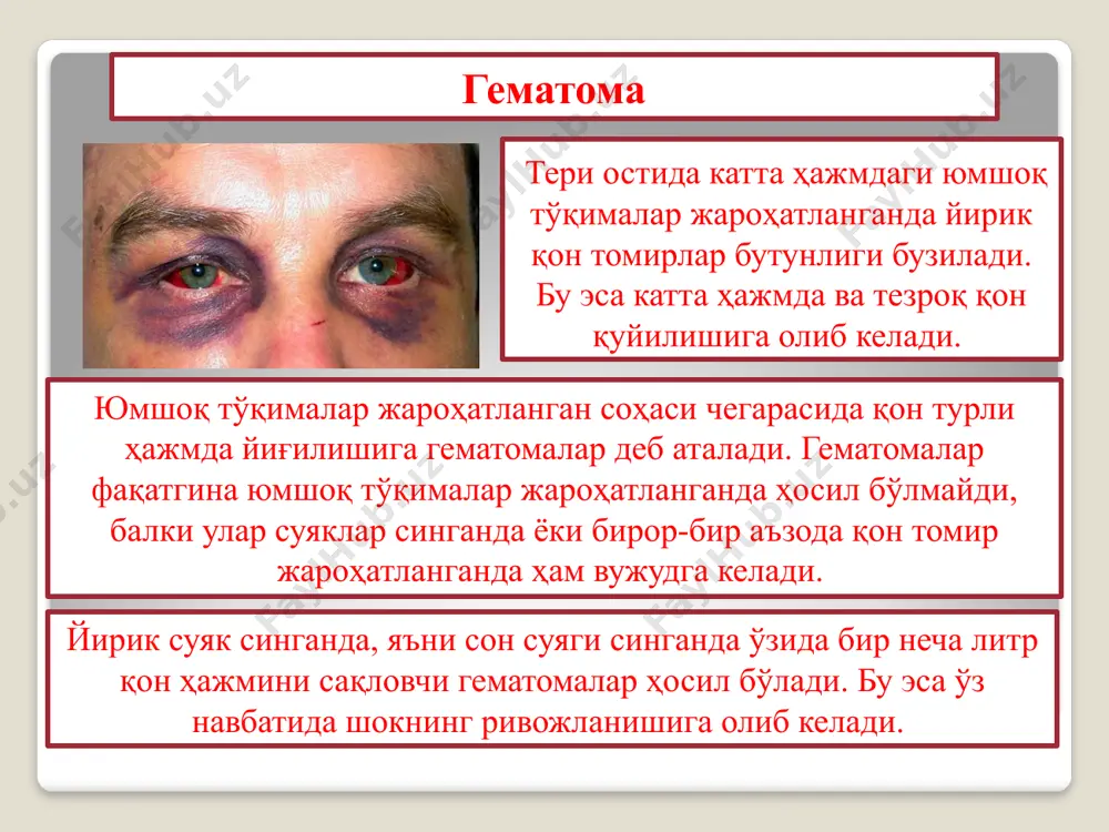 нг жароҳатланишига олиб келади. ушбу жароҳатланишларда ташқи қон кетиш жуда суст ёки умуман кузатилмайди, худди шу пайтда ички қон кетиш жуда кучли бўлиб, шок ҳолатининг ривожланишига олиб келади. мажағланиш 1. odam anatomiyasi. e.qodirov. toshkent-2003. 2. anatomiya. a.s.gusev. moskva-1970. 3. hamshiralik ishi asoslari. q.inomov. toshkent-2007. 4. xirurgiya. a.j.hamrayev. toshkent-2002. 5. xirurgiya va reanimatsiya asoslari. a.j. hamrayev. toshkent-2002. adabiyotlar: image2.jpeg image3.jpeg image4.png image5.jpeg image6.jpeg image7.jpeg image8.jpeg image9.jpeg image10.jpeg image11.jpeg image12.jpeg image13.jpeg image14.jpeg