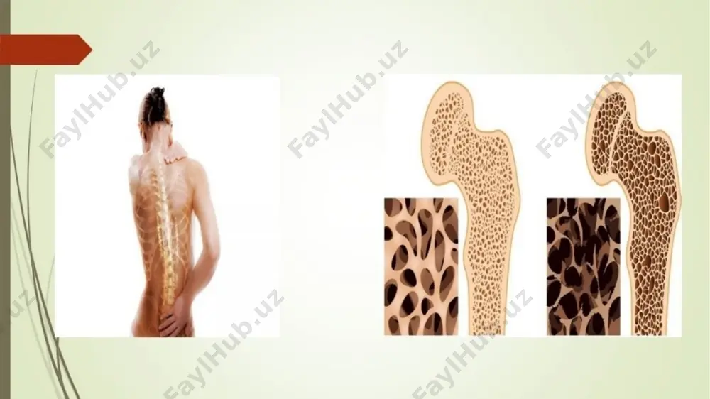 osteoporoz - Page 4