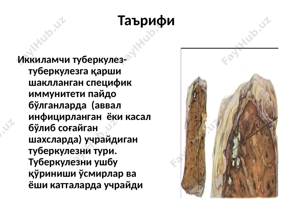 в яллиғланиш реакцияси тез орада продуктив реакция билан алмашади ўчоқли туберкулезни эндоген реактивация оқибатида шаклланиши одатда туберкулез бўйича эпидемиологик холат яхшиланганда кузатилади бирламчи туберкулездан кейин 1-3 йил ўткандан кейин шаклланади аксарият беморларни ўпка паренхимасида кальцинатлар аниқланади бирламчи сил ўрнида колган сил микобактерияларининг кайта жонланиши, яъни зски ноактив колдиқ ўзгаришларнинг фаоллашиши натижасида ривож топади. ушбу колдиқ ўзгаришлар кўпроқ кўкс оралиғи лимфа тугунларида учрайди, чунки бундай сил узок муддат даволашни талаб килади ва ҳар доим ҳам кўнгилдагидек натижа беравермайди. бундай ҳолларда сил касаллигининг фаоллашишида инфекцияиинг лимфоген йўл билан тарқалиши етакчи ўрин тутади. шу билан бир каторда ўпка тўқимасида гематоген диссеминаиия эвазига пайдо бўлган ўчоклар ҳам бўлиши мумкин. ўпка силининг тарқоқ турига ҳимиотерапия ѐрдамида даво қилинганда касаллик тез тузала бошлайди, касаллик ўчоғининг ҳажми кичиклашади. бошқа сил хасталиги турининг келиб чиқиизида ўчоқларнинг тутган ўрнига алоҳида баҳо бериш керак. шуниси дикқатга сазоворки, нокулай омиллар таъсирида ўчоқли сил жараѐни зўрайиб кетиши ва деструктив сил келиб чиқишига …