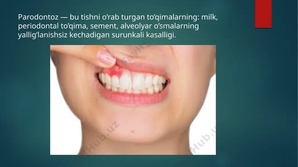 parodontoz nima? - Page 3