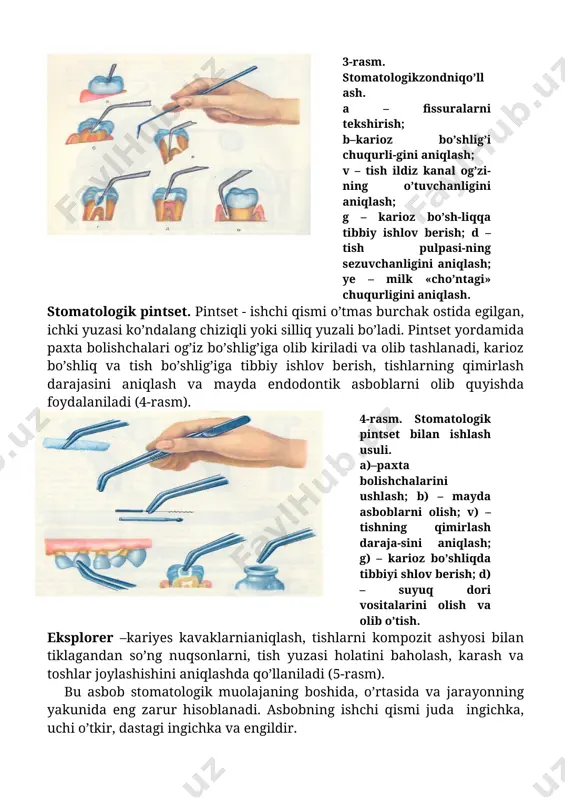 uzunligi va tizzasining bukilganligi bilan ajralib turadi. ba’zi eksplorerlardan kariyes kavaklarini va tish toshlarini aniqlashda foydalaniladi. eksplorerlar maxsus metall qotishmalaridan tayyorlanadi, shuninguchun ular ingichka, egiluvchan va mustahkamdir. eksplorerlarning quyidagi turlari mavjud: 1. bir tomonlamali – ishchi qismi bir tomonlama, kariyesni va tish toshlarini aniqlash uchun. 2. ikki taraflamali nojuft – ishchi qismi ikki xil bo’lgan. 3. ikki taraflama juft – ishchi qismi bir xil bo’lgan; odatda molyarlar orasidagi tish oralig’ini aniqlashda qo’llaniladi. parodontologik zondlar– parodont to’qimasi holatini baholashda qo’llaniladi (6-rasm). ishchi qismi burchak ostida bukilgan, uchi to’mtoq va millimetrli markirovkaga ega. ishchi qismi 60 daraja burchak ostida egilgan bo’lib, to’mtoq uchi yordamida tishning qimirlashini ham aniqlashda qo’llaniladi. ba’zi zondlar qulixusuli bo’yicha rangli kodirovkaga ega. qorachiziqlar bilan harbir millimetr, tasmalar esa 2 yoki 3 millimetrli sohalarni ko’rsatadi. bu kodirovka o’chmaydi va ko’chmaydi. bu zond vrachga tish va milk oralig’idagi chuqurlikni 6 nuqtada aniqlash imkoniyatini beradi. shuningdek zond quyidagi vazifalarni bajarishga yordam …
