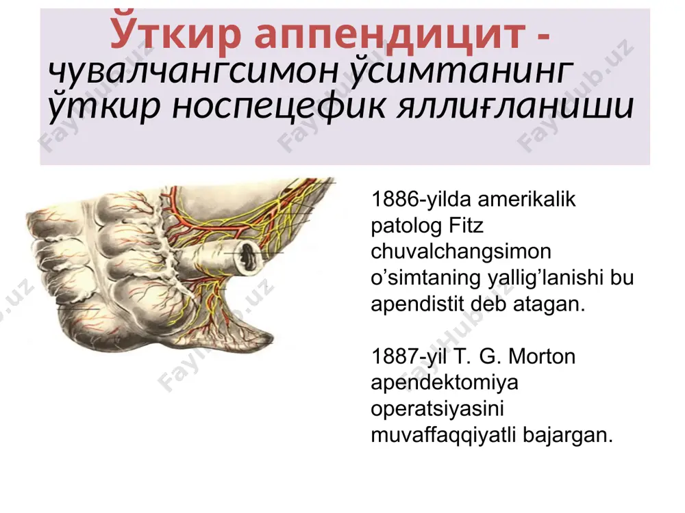 di) 1889-yil charlz mak-burney yozgan edi «meni fikrimcha, o’tkir appendistitda og’riqning eng sezilarli nuqtasi bir barmoq bilan bosilganda o’ng yonbosh suyagining oldingi-yuqori o’sig’i bilan kindik orasidagi chiziq orasidagi bir yarim, ikki dyuymni (3,8 va 5sm.) tashkil qiladi». 2. qusish o’tkir appendistitga reflektor bir yoki ikki marta qayt qilish xarakterli. faqat kichik yoshdagi (3 yoshgacha) bolalarda qayt qilish ko’p marotaba bo’lishi mumkin 3. ichak faoliyatining buzilishi bola yoshiga qarab turlicha bo’lishi mumkin. agar katta yoshdagi bolalarda qabziyat ko’p kuzatilsa, kichik yoshdagi bolalarda bir yoki ikki marotaba ich ketishi (diareya) kuzatilishi mumkin. qayt qilish va ichak funkstiyasining buzilishi ko’p jixatdan qorin parda yallig’lanishiga(kitiqlanishiga) bog’lik 3-yoshgacha bo`lgan bolalarda apenditsitning klinik ko`rinishi appenditsit xastaligi yangi tug`ilgan chaqaloqlarda to`satdan boshlanadi. ona bolaning bezovtalanishi, yig`lashi, ona kukragini olmaedi, tana haroratining 38-40c ga ko`tarilganligi, bir necha marta qusganligi, kam harakatligidan shikoyat qiladi. kasallik boshlanishida ichning suyuq kelishi kuzatiladi. bolada butun qorin devori bo’ylab o’g’riq, eksikoz, ko’p qusish …