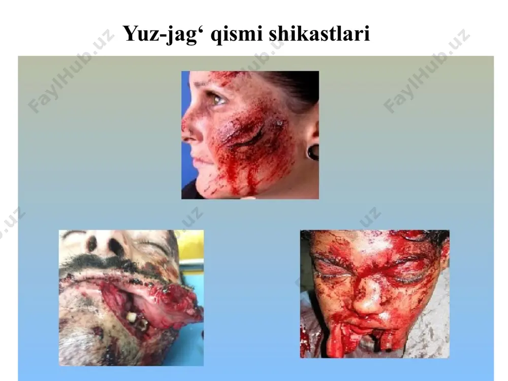 aratishga qaratilgan). yatrogenlarning tasnifi: guruhlar 1 profilaktika choralari bilan bog‘liq bo‘lgan yatrogeniya (tish konlarini olib tashlash qoidalariga rioya qilmaslik natijasida olingan tishning dislokatsiyasi). 2 yatrogeniya kasallikni tashxislash jarayoni bilan bog‘liq. 3 davolash turlari bilan bog‘liq yatrogeniya (dorivor). 4 reanimatsiya bilan bog‘liq yatrogeniya. 5 yatrogeniya, tibbiy xodimlarning salbiy ta’siri tufayli bemorning ruhiyatining o‘zgarishi bilan bog‘liq. 6 yatrogeniya tibbiy yordam ko‘rsatish jarayonini tashkil etishdagi nuqsonlar bilan bog‘liq. 7 yatrogeniya, harakatsizlik, ya’ni tibbiy yordam ko‘rsatmaslik bilan bog‘liq. 8 noto‘g‘ri tashxis qo‘yish va davolash yoki davolash natijasida yangi kasallikning rivojlanishi bilan bog‘liq bo‘lgan “psevdo-kasallik” yatrogeniyasi. 1995-yil fransiyada tibbiy deontologiyaning yangi kodeksi qabul qilindi. ushbu kodeks naslni ko‘paytirishda tibbiy yordam, odamlarda tajribalar, inson tanasining a’zolari va to‘qimalarini transplantatsiya qilish va epidemiologik muammolarni (bioetika) belgilaydigan yangi qonunchilik qoidalarini o‘z ichiga olgan. xalqaro tibbiy axloq kodeksi shifokorlarning umumiy vazifalari shifokor doim yuqori professional standartlarni saqlab turishi kerak. shifokor o‘zining shaxsiy manfaati, kasbiy qarorining erkinligi va mustaqilligi bemorga …