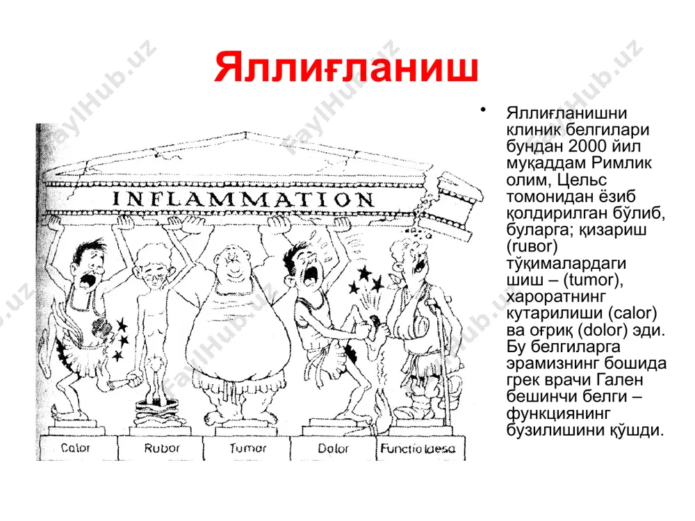 емаси, уларнинг боғлиқлиги ва эффекти яллиғланишни таснифланиши яллиғланишни таснифлашда жараённинг характери, морфологик шакли, экссудатив ёки пролифератив фазаси инобатга олинади. кечиши буйича яллиғланиш ўткир, ўткир ости, сурункали бўлади. шуни алохида қайд килиш лозимки, ўткир ости яллиғланишни фарклаш шартлидир. сурункали яллиғланиш бу-репаратив фазанинг кузатилмаслиги. шунинг учун сурункали яллиғланиш дисрегенерациянинг асосий кўриниши хисобланади. яллиғланиш фазасининг устунлигига кўра экссудатив ва пролифератив яллиғланишлар фарқланади. уларнинг хар бири бир неча турга бўлинади. экссудатив яллиғланиш яллиғланишнинг бу турида иккинчи фаза, яъни экссудация устунлик қилади. бу фаза хужайра ва тўқималар шикастланганидан сўнг турли вақтда яллиғланиш медиаторлари ажралиши билан вужудга келади. капиллярлар ва веналар деворларининг жарохатланиши даражаси ва медиаторлар таъсирининг интенсивлигига кўра экссудатнинг характери турлича бўлади. экссудатив яллиғланиш енгил шикастланишларда яллиғланиш ўчоғида факат кичик молекуляр альбуминлар, оғир шикастланишларда экссудатда йирик молекулали глобулинлар ва нихоят фибиногеннинг жуда йирик молекулалари пайдо бўлади ва фибриноген тўқимада фибринга айланади. экссудат таркибига, шунингдек қон хужайралари, шикастланган тўқиманинг хужайравий элементлари ва бошқалар кириши мумкин. ўткир …