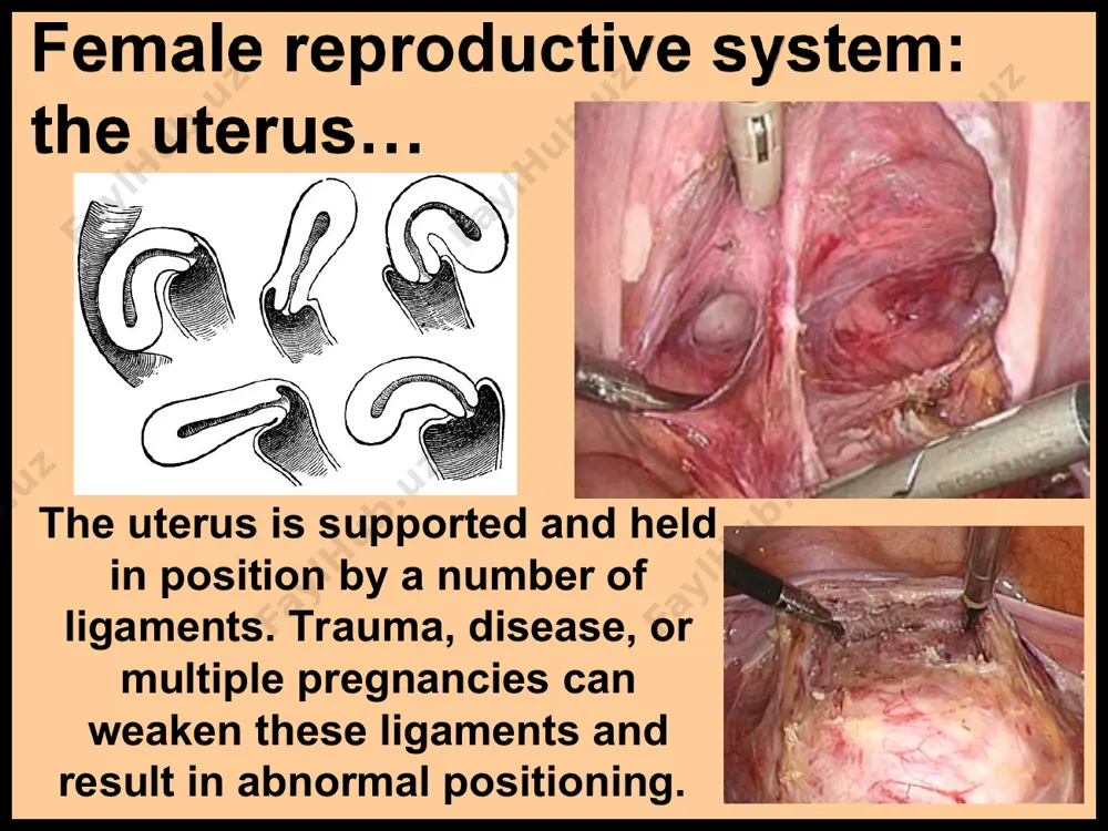 n. during the 1st trimester, all parts of the embryo are formed. during the second trimester all parts start to function; during the last trimester the embryo is now called a fetus and the main task is growth. labor, characterized by muscle contractions, dilation (to 10 cm) and effacement (thinning)of the cervix, and expulsion of the mucous plug that formed in the cervix, signals the onset of parturition… the childbirth process. the cephalic, or head-first delivery, is the most common. breech is a backward presentation; caesarian is delivery through an incision in the abdomen. the umbilical cord is cut and clamped, and placenta (afterbirth) is delivered following birth of the baby. the newborn may be covered with traces of vernix caseosa (cheesy coating) or lanugo (downy hair) that protected the skin before birth. the health of the baby is immediately evaluated on the apgar scale. color, heartbeat, reflexes, muscle tone, …