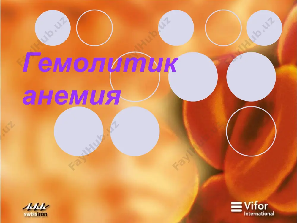 , орттирилган аутоиммун гемолитик анемиялар (гемолизинлар), трансфузиядан кейинги асоратлар, кон гурухи ёки резус-фактор мос келмаслиги, юкори титрдаги антиэритроцитар антитела сакловчи донор конини куйиш ва бошка касалликлар. томир ичи гемолизи эритроцитлар гемолиз hb буйрак каналчаларида сакланган hb, сийдик билан ажраладиган hb, глобин ва гемга ажралиши гем катаболизми hbнинг methb га оксидланиши hb богланади . гаптоглобин фагоцитоз фагоцитоз гем богланади альбумин фагоцитоз ретикулоэндотелиал система гемопексин буйракда томир ичи гемолизи анемия нормохром, нормоцитар (mcv=n, mch=n, mchc=n) ретикулоцитлар 12 ‰ дан куп суяк кумигида эритроид катор гиперплазияси гемоглобинурия сийдик тук – кизил, кора рангда. оксил сезиларли ошган сийдикда конни аниклаш синамаси мусбат чукмада эритроцитлар йук, гемосидерин зардобдаги эркин гемоглобин 3 мг/100мл дан куп (одатда 100 мг/100мл атрофида) гемолитик анемияда суяк кумиги суртмаси куриниши гемолитик анемиялар таснифи i. ирсий гемолитик анемиялар эритроцитлар мембранаси патологияси билан боглик гемолитик анемиялар (эритроцитопатиялар) наслий микросфероцитоз ( минковский-шоффар касаллиги) наслий элиптоцитоз (овалоцитоз) наслий стоматоцитоз наслий --липопротеинемия (акантоцитоз) гемоглобинопатиялар микдорий бузилишлар …