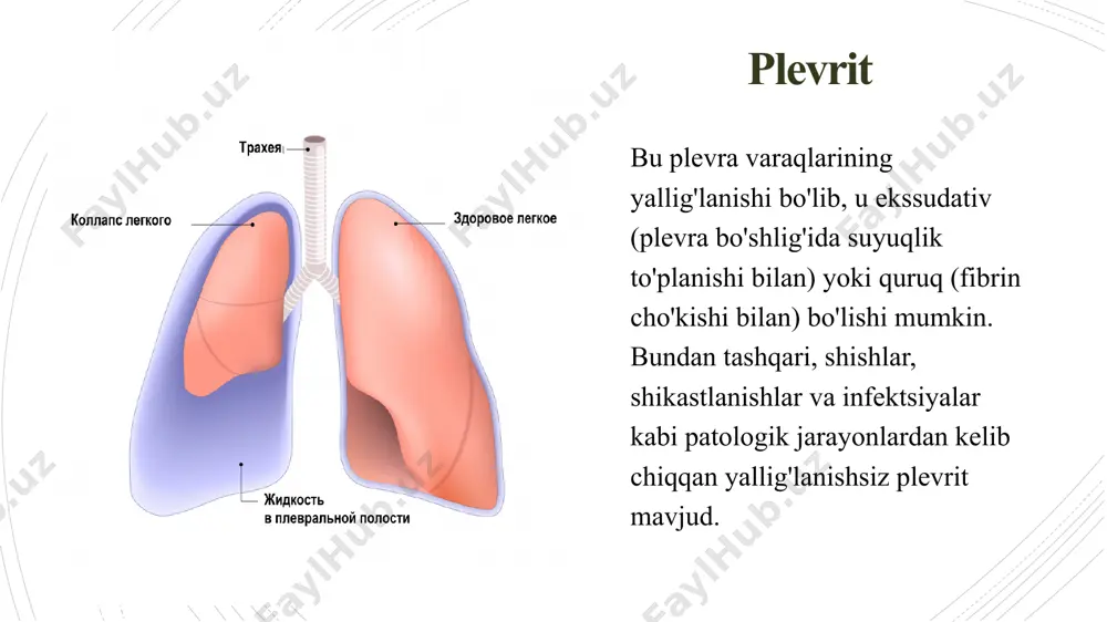 plevritlar - Page 4