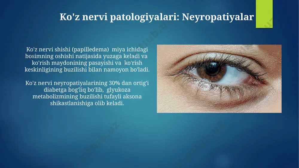 diabetli retinopatiya - Page 4