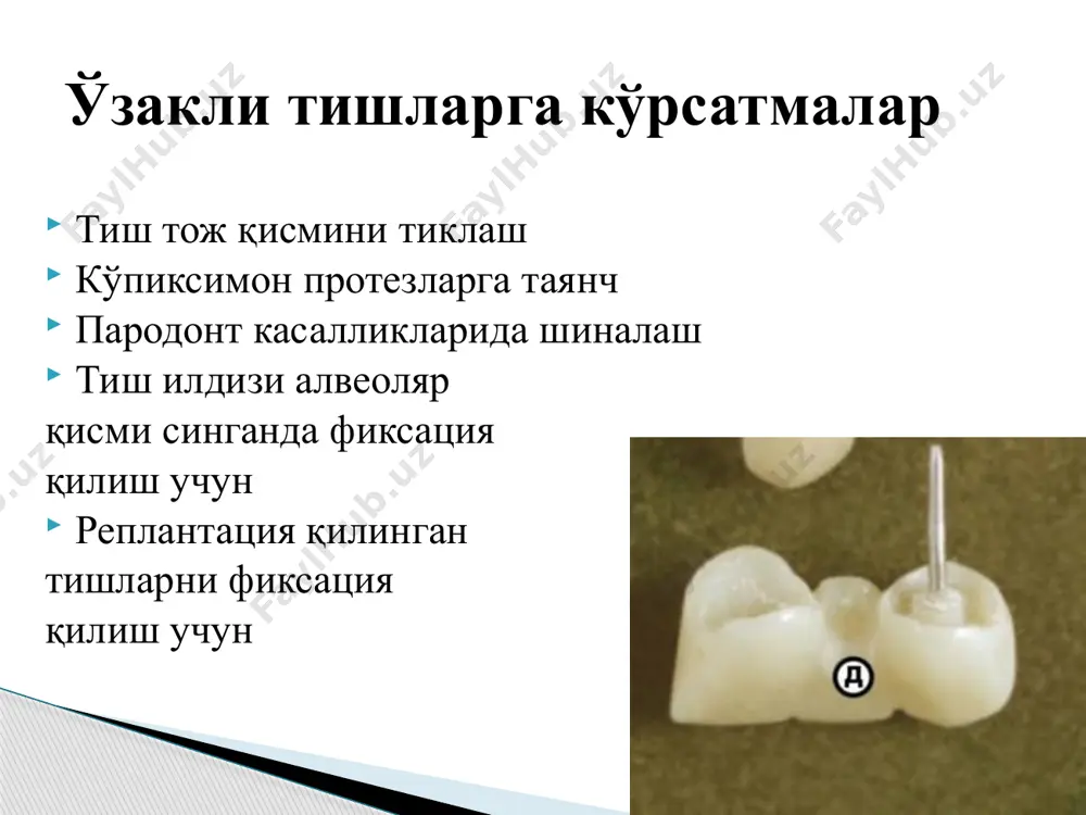 диаторик чинни тиш, ўзак унга махсус шайба билан махкамланади (стандарт) логан бўйича – чинни қоплама ва ўзакдан иборат (стандарт) анкер стандарт ўзаги бекметов бўйича – сигментли ўзакли тиш (кўп илдизли тишлар учун) ортон бўйича – тўлиқ қуйма, вкладкали таянчи билан ильина-маркосян бўйича – илдиз кириш қисмида куб шаклидаги қуйма вкладкали копейкин бўйича – культли ўзакли тиш 3. ўзакнинг илдизга кириш қисмида герметикликни таъминлайдиган вкладкали ўзаклар ортон бўйича қуйма ўзакли тишлар кўрсатма 1. милк чегарасида бўлганда 2.илдиз тўқимасини субгингивал шикастланишида л.в.ильина-маркосян бўйича ўзакли тиш л.в.ильина-маркосян бўйича ўзакли тишнинг клиника –лаборатория боскичлари 1.илдизнинг милк усти қисмини чархлаш ва киритма учун куб шаклида ковак тайёрлаш. 2.тиш илдизидаги ковакни кенгайтириш. 3.ўзакни тайёрлаш, мослаш ва илдиз юзасида мумли киритмани ясаш (ўзак ва киритмани мумдан шакллантириш мумкин). 4.мумли тузилишдаги киритмани металлга алмаштириш (қуйиш). 5.металли киритмани илдиз юзасидаги ковакка мослаб кўриш, ўзак билан бирга гипсли қолип олиш. 6.асл нусхалар тайёрлаш. 7.тиш тожини пластмассага алмаштириш. 8.ўзакли тишга ишлов …
