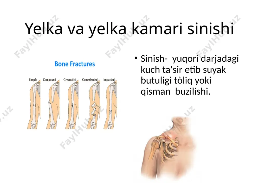 yelka kamari shikastlanishlari - Page 5