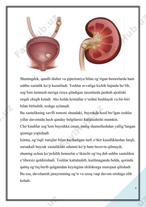bu toshni ko’rish, uning zichligi, hajmini hisoblash, siydik tizimining arxitektonikasi, atrofdagi to’qimalarning holatini ko’rish imkonini beradi. agar kerak bo’lsa, 3d-rekonstruktsiya amalga oshirish mumkin. · buyraklar funktsiyasini va uning buzilish darajasini o’rganishga imkon beruvchi dinamik va statik nefrostsintigrafiya. · antibiotiklarga sezuvchanlik bilan siydik ekish siydik yo’lidagi infektsiyani, yallig’lanish darajasini aniqlashi mumkin. multispiral kompyuter tomografiyasi dinamik buyrak sintigrafiyasi buyrakda toshni davolash ko’rik natijalarini olgandan so’ng, urolog muayyan klinik holat uchun davolash taktikasini aniqlaydi. bugungi kunda urologlar arsenalida turli xil davolash usullari mavjud, ular orasida: · toshning mustaqil chiqib ketishiga yo’naltirilgan dori-darmonlar; · toshni eritishga qaratilgan medikamentoz davolash; · ochiq jarrohlik aralashuvlar; · distantsion zarb-to’lqinli litotripsiya; · endoskopik kontakt litotripsiya; · teri orqali nefrolitotripsiya; · endoskopik jarrohlik aralashuvlar. yaqin vaqtgacha siydik-tosh kasalligini davolashda ochiq jarrohlik muolajalari yetakchi usul hisoblangan, ammo tibbiy asbob-uskunalarning rivojlanishi sababli ular ikkinchi darajali bo’lib qoldi va hozirda faqat qat’iy ko’rsatmalar mavjud bo’lganda qo’llaniladi. distantsion zarb-to’lqinli litotripsiya, endoskopik usullar (kontakt …