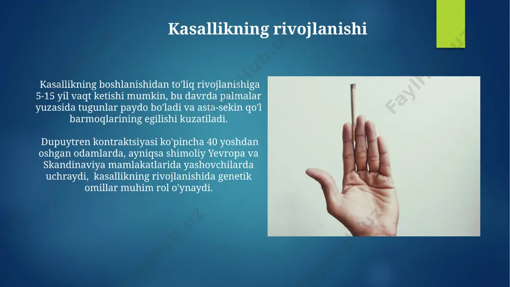 dyupyuitren kontrakturasi - Page 4