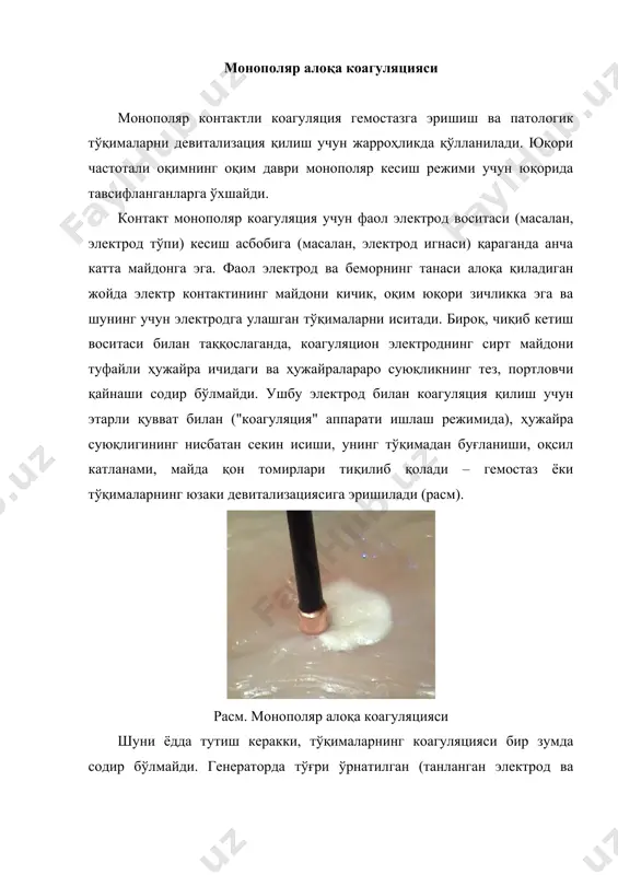 н танишишингиз керак. қоида тариқасида, мажбурий ва чуқур контакциз коагуляция "фулгур", юзаки контакциз коагуляция "бузадиган амаллар"деб номланади. контакциз коагуляция учун кесиш учун электродлар (пичоқлар, игналар, илгаклар, илмоқлар) ва алоқа коагуляцияси учун электродлар (тўплар, "тугмалар") ишлатилиши мумкин. аргоноплазма коагуляцияси аргоноплазмалик (аргон) коагуляция бу контакциз монополяр коагуляциянинг бир тури. ушбу усул ёрдамида фаол электрод, фаоллаштирилган электрожарроҳлик аппарати билан, инерт, осон ионланадиган газ – аргон билан пуфланади. фаол электрод тўқималарга яқинлашганда, аргон муҳитида йўналтирилган оқинди пайдо бўлади, аргон плазмасининг массаси ҳосил бўлади (расм). юқори частотали оқим фаол электроддан аргон плазма массаси орқали, беморнинг танаси орқали ўтади ва нейтрал электродга тарқалади. беморнинг танаси аргон плазмасига машъал билан тегиб турган жойда тўқималарнинг контакциз монополяр коагуляцияси содир бўлади. расм. аргоноплазмик коагуляция контакциз аргоноплазмик коагуляциядан фойдаланиш қуйидаги афзалликларга эга: · инерт газ аргон кислородни коагуляцион зонадан чиқариб юборади, тўқималарнинг чаррланишига (карбонланишига) тўсқинлик қилади, чуқур исиниш содир бўлади, бунинг натижасида операциядан кейинги даврда репаратив жараёнлар тўқималарни рад қилмасдан …