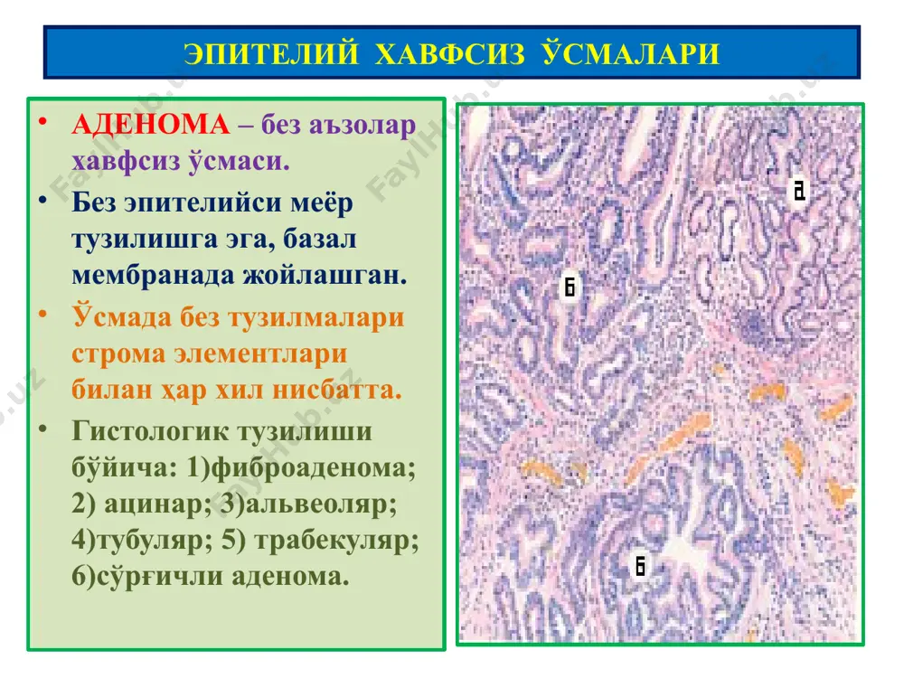 ўсмалар. мезенхимал ўсмалар - Page 3