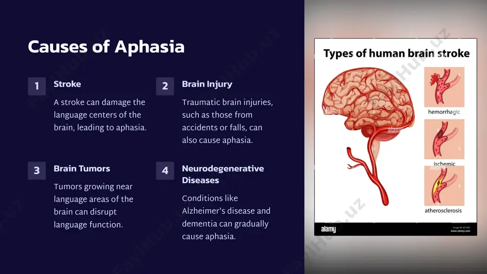 aphasia: understanding language loss - Page 3
