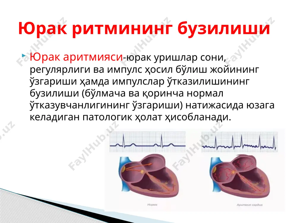 иги кичик 2.хамма уланишларда pqrst-булиши ва р тиш i, ii, avf, v4-v6 да мусбат синусли тахикардия 1. юус 59-40 та, r-r оралиги узайган. 2. хамма уланишларда pqrst – борлиги аникланади. синусли брадикардия 1. r-r оралиги хар хил, 0,15с дан фарки катта ва нафас олиш билан боглик. 2. хамма уланишларда p ва qrst борлиги аникланади. синусли аритмия 1.баркарор синусли брадикардия. 2.вакт – вакти билан эктопик ритмлар пайдо булиши. 3.са блокада булиши. 4.тахикардия – брадикардия синдроми. синус тугуни сустлиги синдроми умумий белгилар— тери рангпарлиги, оёқ ва қўллар уюшиши, мушак ҳолсизлиги, ҳарактланганда ўтиб кетувчи оқсоқланиш; бош мияга алоқадор белгилар — ҳушдан кетиш, бош айланиши, қулоқда шовқин, сезгининг бузилиши, эмоционал лабиллик хотира пасайиши, қариялар ақлий заифлиги; юрак қон томир белгилари — юрак ўйнаши, юрак тўхташи, ҳаттоки жисмоний ҳарактда пулснинг камлиги, тўш ортида оғриқ, нафаснинг ўзгариши. ҳушдан кетиш клиник белгилар экстрасистолия - эктопик ўчоқлардан ҳосил бўлувчи импулслар натижасида юракнинг навбатдан ташқари, вақтдан олдин қисқариши ҳисобланиди. …