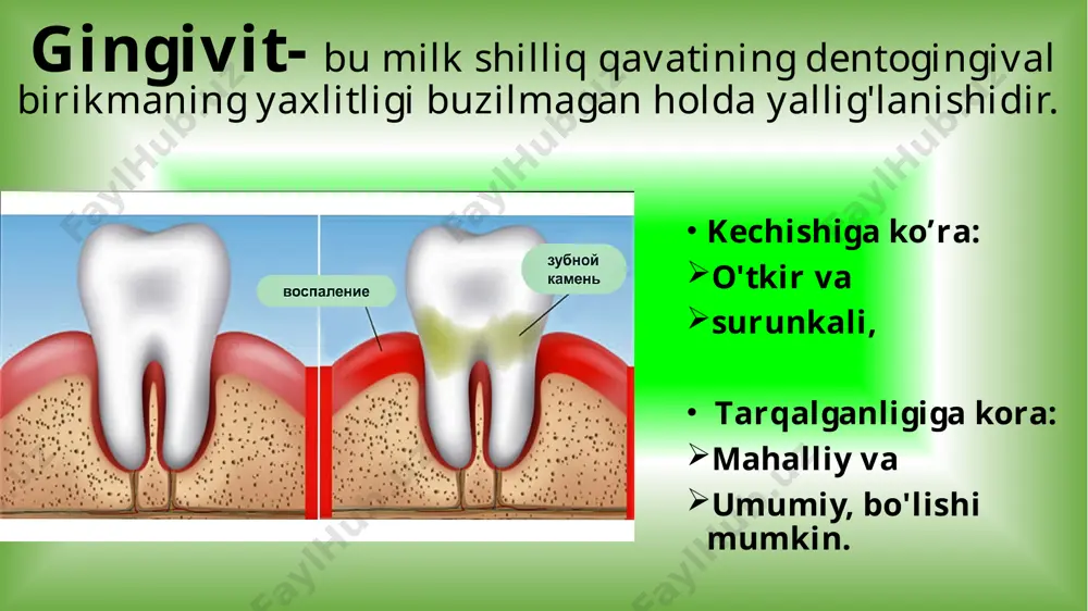 hlig’i yumshoq to’qimalarining anomal taraqqiyoti (og’iz daxliz qismining tor bo’lishi, lab yuganchasining qisqaligi yoki noto’g’ri birikishi). umumiy omillar; endokrin (qandli diabet, isenko-kushing kasalligi, jinsiy a’zolar kasalliklari), nerv tizim kasalliklari (oligofreniya), revmatik kasalliklar, oit kasalliklari (yara kasalligi, surunkali gepatit), yurak-qon tomir tizimi kasalliklari (ateroskleroz, qon bosimi kasalligi), modda almashinuvining buzilishi bilan bog’liq kasalliklar, avitaminozlar. umumiy va maxalliy omillar;- tish karashlari va toshlari tarkibi-dagi mikroorganizmlar rivoji uchun qulay sharoitni yaratib beradi bu esa gingivit va paradontit rivoji uchun turtki bo’ladi. shu asosda so’lak va og’iz bo’shlig’i suyuqligining sifati va miqdori xam o’zgaradi. bu tish karashlari va tosh xosil bo’lishini stimullaydi. jarayonga yallig’lanishning qo’shilishi va u erga lizosomal fermentlarning ajralishi, yallig’lanish meditorlarining ajralishi paradont suyak to’qimalarining destruksiyasini kuchaytiradi. paradontitlarning patologik anatomiyasi. makroskopik: jarayonlar surunkali kataral va gipertrofik gingivitlar ko’rinishida yuzaga chiqa boshlaydi. milkning so’rg’ichlarida, marginal qismida, alveolyar qismlarida yallig’lanish belgilari (qizarish, shish) kuzatiladi. milk kattashadi (gipertofik gingivit). yallig’lanish sababli tish-milk bog’liqligi, keyin esa …