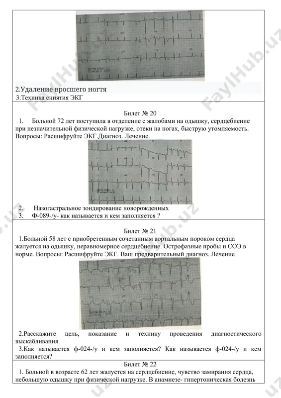 ннего возраста 3. наружный акушерский осмотр билет №37 1.техника снятия экг 2. неотложная помощь при судорогах 3.при проведении медицинского осмотра среди населения, обслуживаемого ссп, выявлены больные лица. какие мероприятия необходимо проводить с выявленными больными и как документ необходимо оформить? билет №38 1.больной 59 лет жалуется на загрудинные боли сжимающего характера с иррадиацией в длительностью до 2х часов. снята экг. вопросы: расшифруйте экг. ваш предварительный диагноз. ваша тактика. 2. неотложная помошь при анафилактическом шоке 3.среди 35600 детского населения свп 34500 были проведены профилактические прививки. какой документ заполняется и какой показатель можно вычислить? билет №39 1.техника проведения офтальмоскопии 2.техника наложения швов донати после хирургической обработки раны 3.расскажите технику проведения бимануального (двуручного) исследования гинекологических больных билет №40 1.техника проведения пикфлоуметрии 2.расшифровка экг 3.неотложная помошь при ларингоспазме билет № 41 1.больная 74 лет жалуется на боли, удушье, пенистую мокроту положение ортопноэ, акроцианоз, чдд 30 в/в 1 ад 110/70.вопросы: расшифруйте экг. ваш предварительный диагноз. ваша …