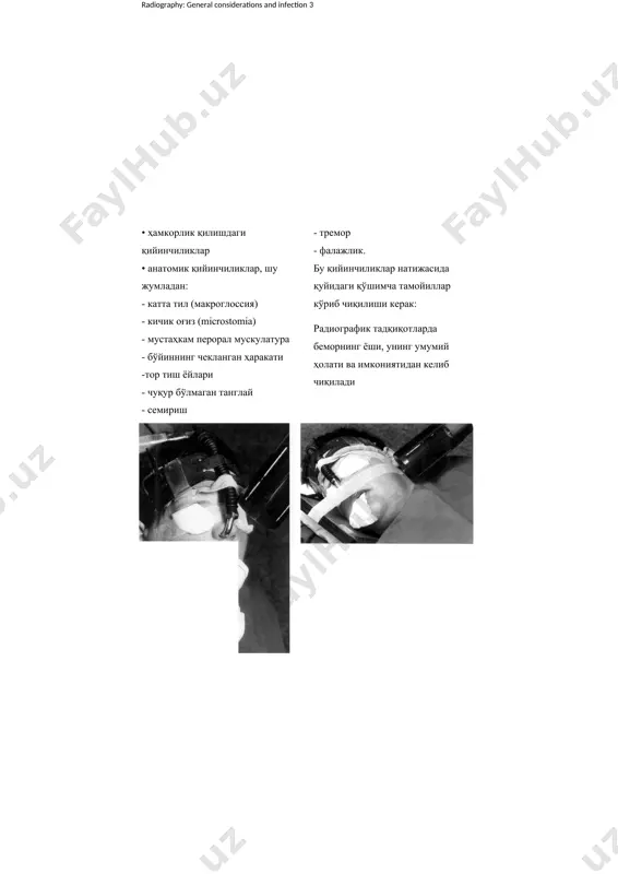 амчи учун зарур ҳимоя чоралари тўғрисида хабар бериши керак. • умумий наркоз остида рентгенография ни амалга ошириш зарур бўлганда, агар бемор гапга кирмаса уларнинг тишларини даволаш шундай тарзда амалга оширилади (қаранг. 7.1). рентгенограммада одатда эгри суяклар билан чекланилади ва периапикал тарзда қабул қилиниши мумкин. • беморни ўз ўрнида тахминан 18 секунд қолдириш учун зарур бўлганда стоматологик панорам томографиядан воз кечиш (.боб 15). қопланган ён рентгенограммалар оғиздан ташқарида танлаш шакли сифатида кўриб чиқилади . • агар периапикал радиография учун мумкин бўлса, параллеллаштириш усулидан фойдаланинг чунки бунда беморнинг боши қандай жойлашганидан қатъий назар пленка пакетлар, тишлар ва рентген тўпламлар ўрни сақланади (боб 8). буюк британияда инфекциялар назорати, иш жойларида саломатлик ва хавфсизлик, 1974-йилдаги қонунга кўра шифохоналарда ишлайдиган ҳар бир шахс ёки умумий амалиёт шифокори (соғлиқни сақлаш ҳодими ёки тиббий ҳодим) ўзини, ўз жамоаси ва беморларни ҳимоя қилиш учун инфекциялар юқишини олдини олиш мақсадида барча зарур чораларни кўриш бўйича юридик мажбуриятларга эга бўлади. …