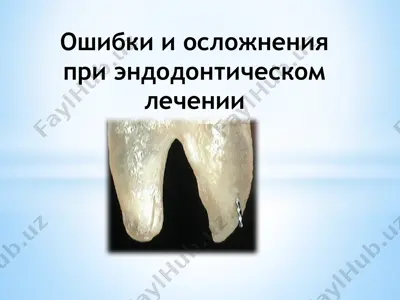 ошибки и осложнения при эндодонтическом лечении — PPTX