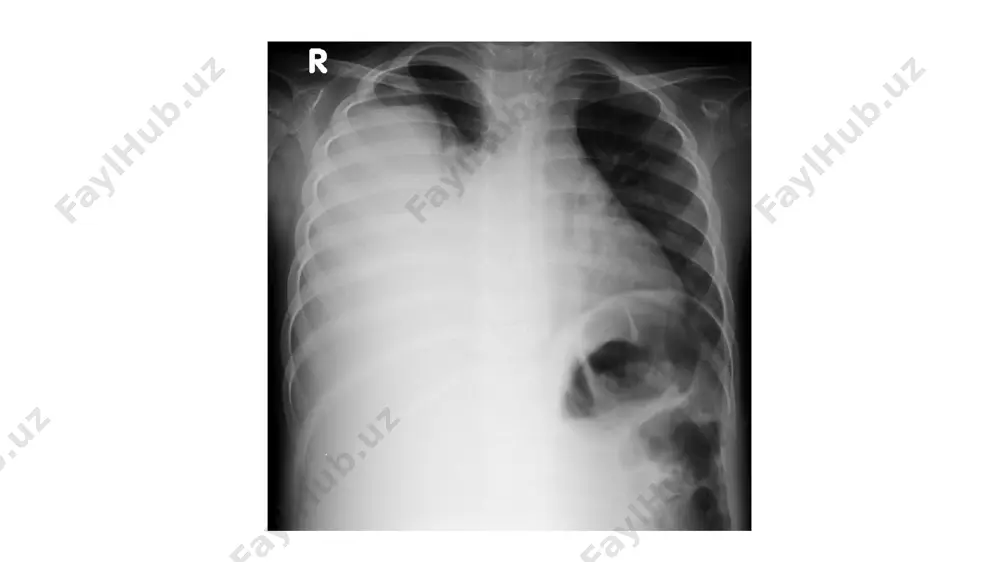 lung - Page 5