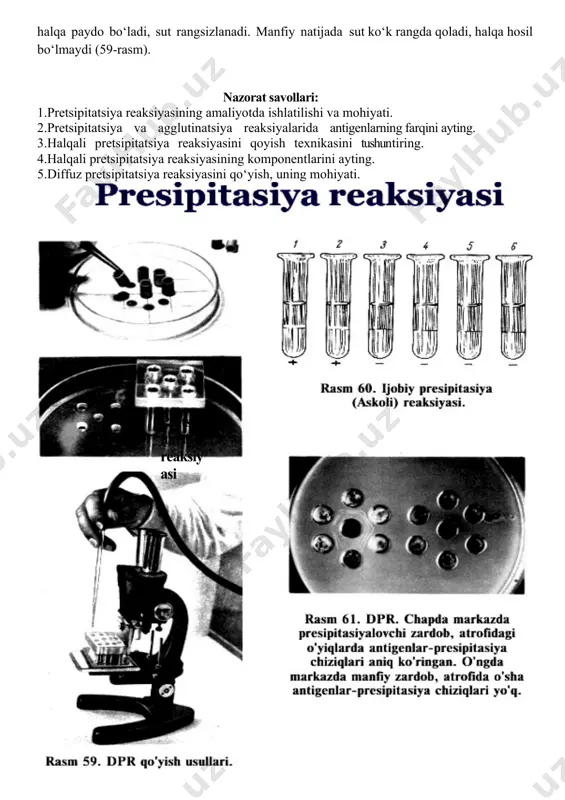 va oxirgi probirkadan dezinfiksiyalovchi eritmali idishga quyiladi. ikkinchidan boshlab hamma probirkalarga bir xilda 0,05 ml dan antigen quyiladi (1 ml da 10 mlrd mikrob hisobidan). komponentlarning umumiy hajmi 1 ml bo‘ladi (56-rasm). har bir komponent uchun alohida pipetka ishlatiladi. probirkalar yaxshilab silkitib aralashtiriladi va 37 0c da 4-6 soat termostatda keyin 14-16 soat uy haroratida turadi. bir vaqtda nazorat reaksiyasi qo‘yilishi shart: 1. ijobiy brutselloz zardobi + standart brutselloz antigeni natija - (++++) ijobiy. 2. normal zardob + standart brutselloz antigeni natija (-) manfiy. 3. standart brutselloz antigeni + fiziologik eritma natija (-) manfiy. natijani hisobga olish (57-rasm) nazoratli probirkalardan boshlanadi. 1. cho‘kma soyabon shaklida, suyuqlik tiniq-100% agglutinatsiya (++++). 2. cho‘kma soyabon shaklida, suyuqlik salgina loyqa-75% agglutinatsiya (+++). 3.suyuqlik loyqa, soyabon yaxshi hosil bo‘lmagan–50% agglutinatsiya (++). 4. cho‘kma tugma shaklida, suyuqlik loyqa – 25 % agglutinatsiya (+). 5. suyuqlik loyqa, soyabon hosil bo‘lmagan – agglutinatsiya yo‘q (-). 1:100 nisbatda agglutinatsiya …