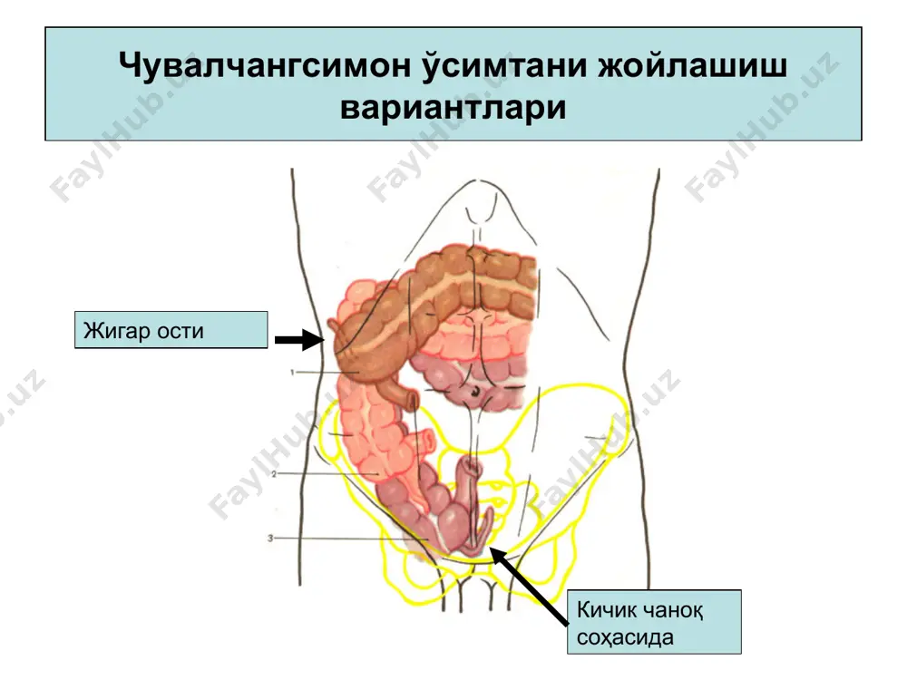ўткир аппендицит - чувалчангсимон ўсимтанинг ўткир носпецефик яллиғланиши - Page 4