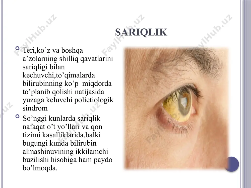va fototerapiya -qon komponentlarini quyish klinikasi qon tahlilida -turli darajadagi gemolitik kamqonlik -anemiya normoxrom xarakterda -echt yuqori -retikulotsitlar miqdri 40-50% oshgan biokimyoviy tekshiruvda -zardobda bog’lanmagan bilirubin oshgan -umumiy blirubin miqdori-68-85mkmol/l mexanik sariqlik bilirubin o’t yo’llari orqali chiqishining buzilishi gepatotsitlarda bilirubin ekskretsiyasining pasayishi patologik jarayon magistral o’t yo’llarida etiologiyasi -jigardan tashqarida joylashgan o’t yo’llari yallig’lanishlari -jigar va umumiy o’t yo’llarini ichkaridan o’t toshlari,gelmintlar bilan obturatsiyasi -umumiy o’t yo’lining tashqaridan qisilishi(o’smalar,limfa tugunlari kattalashishi hisobiga) -umumiy o’t yo’li stenozi(chandiq,bitishmalar) -o’t yo’llari atreziyasi,o’t yo’llari gipoplaziyasi obyektiv teri-qora rangga o’tuvchi to’q yashil tusda; -kuchli qichishish siydik-to’q rangda najas-rangsiz,chirigan oqish-qo’ng’ir rang(tarkibida sterkobilin aniqlanmaydi,yog’ kislotalari va sovun aniqlanadi-steatoreya) bemorda holsizlik,kaxeksiya,dispeptik belgilar,tez charchash,qayt qilish kuzatiladi qonda bog’lanmagan bilirubin ko’p,xolesterin,o’t kislotalari to’plangan,ishqoriy fosfataza miqdori oshgan klinikasi o’ng kurak sohasi,to’sh suyagi orqasi,o’ng yelkaga beruvchi o’ng qovurg’a ostida doimiy,keskin,xurujsimon og’riqlar o’t sanchig’i xurujlarining bo’lishi meteorizm,dispeptik simptomlar yo’li taomlardan so’ng epigastral sohadagi noxush sezgi palpatsiyada og’riq kuzatiladi laborator tashxis qonda bog’langan bilirubin …