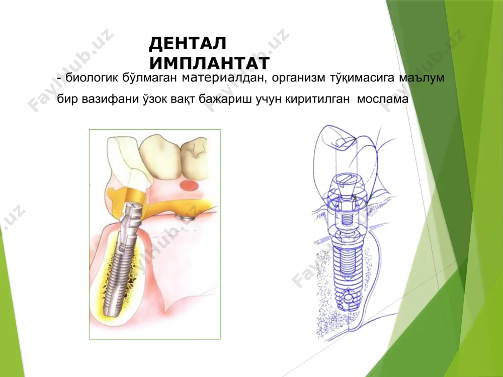 suyak ichi implantlari - Page 3
