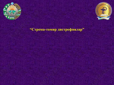 строма-томир дистрофиялар — PPT