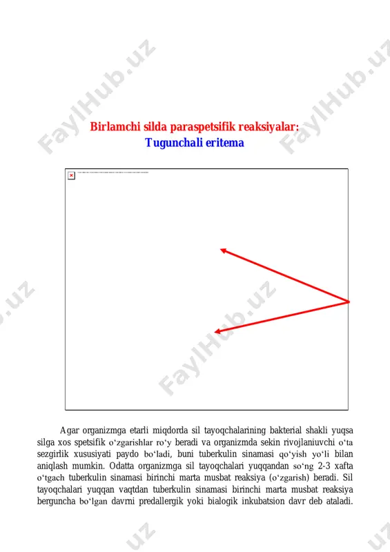 tomirlar soyasidan iborat v) o‘ngda o‘ng bo‘lmachasining yarmi, yukorida yo‘nalgan aorta; g) chapda aortaning pastki yo‘nalgan kismi, o‘pka arteriyasi konusi va chap bo‘lmacha va chap qorincha. d) oraliq a’zolari soyasining to‘g‘ri tuzilishi, tushayotgan tomchi, muri trubasi, «o‘tirgan o‘rdak» ni eslatuvchi xolatlar. e) siljigan, siljimagan, kengaygan. 6. diafragma o‘zgarishi: a) tuzilishi, b) diafragma soyasi gumbazsimon (normada, o‘ngda vi oldingi qovurg‘asi, chapda viii qovurg‘asi soxasida joylashgan; v) diafragma soyasining yasilanishi; g) siljisi (ko‘tarilgan, tushgan). 7. plevrada o‘zgarishlar: a) soyalanishi (to‘liq soya, yuzada, yo‘l bo‘ylab); b) kengaygan, joylashuvi, zichlanishi; v) o‘pka maydonining kengayishi, torayishi. 8. plevra sinuslari: a) qovurg‘a-diafragmal sinus(o‘tkir, o‘tmas); b) oraliq-diafragmal sinus-burchagi 90s o‘ngda, 60-70 chapda: 9. o‘pka ildizlari: a) ii-iv qovurg‘alar oralig‘ida joylashuvi b) yarimoysimon ko‘rinishda v) chegarasi aniq, aniq-emas g) tuzilishi: kengaygan, strukturali, strukturasiz d) xajmi-kengaygan, toraygan, siljigan, zichlashgan. e) bolalarda ildiz soyasi kengligi-0-5-1 sm, ayollarda-0,1-1,5 sm, erkaklarda 1,5-2 sm. 10. o‘pka surati: kuchaygan, xiralashgan, deformatsiyalangan. 11. o‘pka maydoni: …