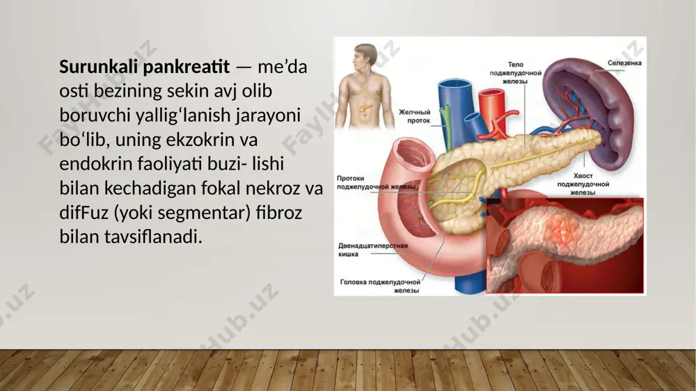 isiga kolra: shishli shakli sklerotik-atrofik shakli fibroz (diffuz va diffuz tugunli) shakli psevdokistoz shakli kalsifikatsiyalangan shakli klinik belgilarning xususiyatiga kolra: polisimptom shakli og‘riqli shakli psevdoo'smali shakli dispeptik shakli latent shakli kasallikning bosqichlariga kolra: remissiya qo‘zish davri kasallik kechishiga kolra: yengil darajadagi pankreatit (i boshlang‘ich bosqich) o‘rta og‘ir darajadagi pankreatit (ii bosqich) og'ir darajadagi pankreatit (iii bosqich, terminal, kaxeksik). klinikasi surunkali pankreatitning klinik manzarasi og'riq va dispepsiya sindromi hamda ekzokrin va endokrin faoliyatning yetishmovchiligi belgilaridan iborat. obyektiv ko'rilganda: teri qoplamlarining quruqligi, glossit, stomatit (gipovitaminoz natijasida), tana vaznining kamayishi va paypasla- ganda me’da osti bezi sohasida og‘riq va frenikus belgisining musbatligi aniqlanadi og'riq sindromi. og‘riq ovqatdan (achchiq, qovurilgan,yog‘li) 40— 60 daqiqadan so'ng paydo bo'ladi. og‘riq o'tkir, asta-sekin kuchayib boruvchi yoki doimiy, to‘mtoq, ezuvchi tusda, ovqat yegandan so‘ngkuchayishi mumkin. og‘riq joylashuvi meda osti bezining zararlangan anatomik sohasiga bog'liq. chap qoviirg‘a ravog'i ostidagi og‘riq me’da osti bezining dum qismi zararlanganligidan dalolat beradi. me'da osti …