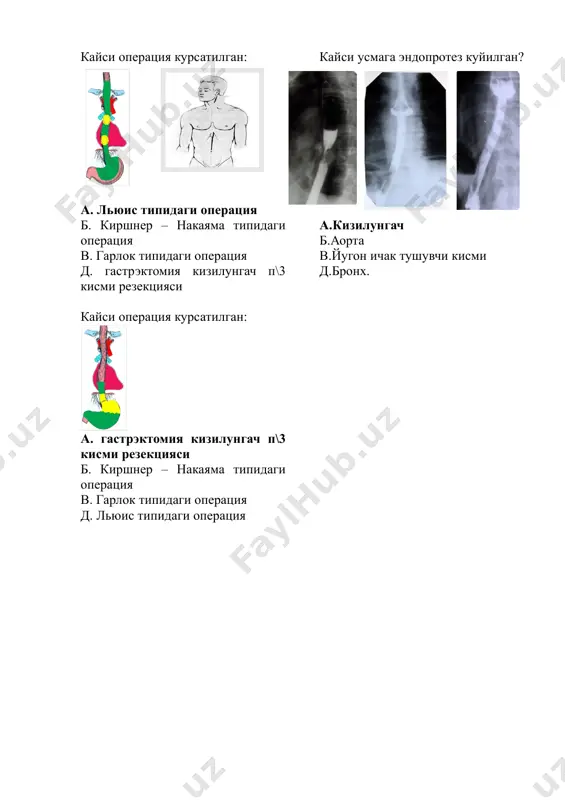 melanoma diagnostikasi - Page 3