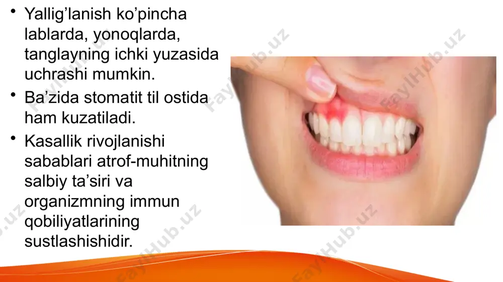 surunkali aftoz stomatit terapevtik davo - Page 5