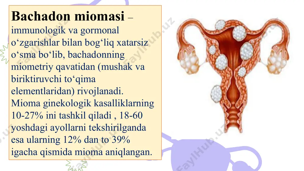hi sabab paydo bo’lishi mumkin. inson organizmida endogen estrogenga o’xshash moddalar aniqlangan va bachadon miomasi ularga xuddi estrogenlar kabi sezuvchanlikka egadir. ushbu moddalar ksenoestrogenlar deyiladi va ularning mavjudligi, shuningdek, o’sma shakllanishiga turki bo’lishi mumkin. иммун тизимининг ўрни табиий киллерларнинг ортиши; т-лимфоцитларнинг камайиши; периферик т-хелперларнинг ошиши; иммун тизимининг бузилиш даражасининг миоматоз тугунлар сонини билан корреляцияси; миоматоз тугунлар сонининг ортиши, в-лимфоцитларнинг камайишига олиб келади тугма ҳамда гуморал иммун тизими жараени активацияси фонида иммуносупрессив компонентларнинг ошиши jоylashuvi bo‘yicha : - subsеrоz – qorin bo’shlig’i tomon, - intramural yoki intеrstitsial - muskullararo - submukоz – shilliqosti , bachadon bo’shlig’i tomon - intraligamental – boylamlar orasidagi mioma klassifikatsiya классификация (figo, 2011) турлари: 0 – субмукоз; 1 – субмукоз, ˂50% интрамурал компонент; 2 – субмукоз, 50% интрамурал компонент; 3 – интрамурал, эндометрийга якин; 4 – интрамурал; 5 – субсероз, >50% интрамурал компонент; 6 – субсероз, ˂50% интрамурал компонент; 7 – субсероз; 8 – бошка локализация 0 …