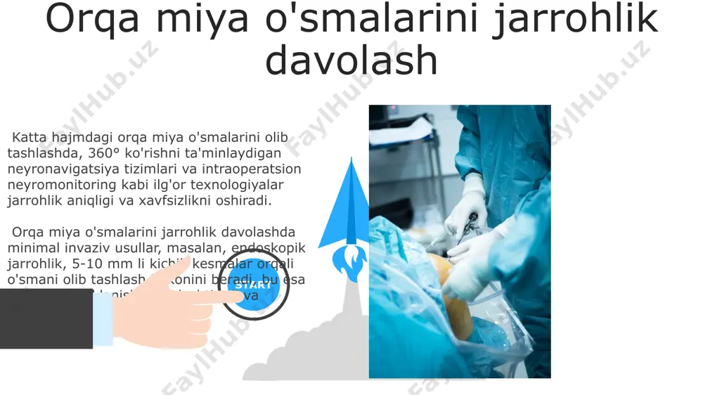 ar kuzatiladi, ammo bu ko'rsatkich bemorning yoshi, skolioz darajasi va umumiy sog'lig'iga bog'liq bo'ladi. orqa miya stenozi jarrohligi orqa miya stenozi jarrohligi natijalari, bemorning yoshi, umurtqa pog'onasining shikastlanish darajasi va umumiy salomatligiga bog'liq bo'lib, 80% hollarda og'riq sezilarli darajada kamayadi. orqa miya stenozini jarrohlik davolashda, lumbal mintaqadagi torayish darajasiga qarab, 10-20% hollarda laminectomiya yoki laminotomiya kabi minimal invaziv usullar qo'llaniladi. orqa miya fiksatsiyasi va stabilizatsiyasi orqa miya fiksatsiyasi va stabilizatsiyasi jarayonida, umurtqa pog'onasining 2-3 ta segmentini birlashtirish uchun turli xil vintlar, plastinalar va tayoqchalardan foydalaniladi, bu esa umurtqa pog'onasining barqarorligini ta'minlaydi. operatsiyadan keyingi davrda, bemorlarning taxminan 85-90%ida umurtqa pog'onasining barqarorligi tiklanadi va og'riq sezilarli darajada kamayadi, ammo to'liq tiklanish vaqt talab qiladi. 06 05 04 spondilolistez jarrohligi 01 02 spondilolistezning ogʻir shakllarida, umurtqa pogʻonasining beqarorligi va asab siqilishini bartaraf etish uchun, 10% dan ortiq holatlarda, spinal fussion bilan birga instrumentatsiya (vintlar va tayoqchalar) oʻrnatish talab qilinishi mumkin. spondilolistez jarrohligida, 60° …