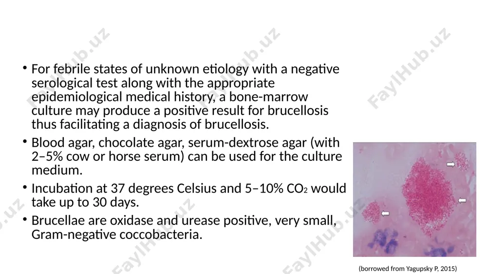 n-o stained antigens to b. abortus 1119-3 interpretation positive result is achieved if the cells settle on the well bottom and form an even layer agglutination at a serum dilution of 1:200 indicates the presence of brucellosis agglutination >1:50 at a serum dilution of <1:200 is not evidence of brucellosis false positive: specificity 95% to 100% false negative: sensitivity 70% to 91.5% negative result is manifested by red-stained cells that are deposited on the well bottom and form pellets limitations this test is not suitable for detecting brucellosis caused by b. canis or the rough strain cross-reactivity with the serum from patients infected with other antigenically similar bacteria 17 wright test titer of ≥1:200 (the foreign literature references 1:160) indicates brucellosis if confirmed by the clinical picture and epidemiological history. however, in endemic countries, where antibodies are often found in the populace, the diagnostic titer must be ≥1:400 (the foreign …