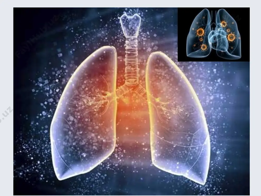 qarab koronavirus infektsiyasi barcha yuqori nafas yo'llari kasalliklari-ning10-35% ini tashkil qiladi. koronavirus infektsiyasi kuzning oxiri, qish va bahorning boshlarida (rinovirusli infektsiya kam uchraganda) ko'p uchraydi. patogenezi etarlicha o'rganilmagan, bu virus kattalarda yuqori nafas yo'llarini, bolalarda esa o'pka hamda bronxlarni zararlaydi. cv-24 va cv-25 odam koronaviruslari gastroenterit bilan kasallangan bolalar najasidan hamda tarqalgan, skleroz bilan kasallanganlarning bosh miyasidan topilgan. koronavirus infektsiyasi burun xalqumdagi kipriksimon epiteliyga aminopeptidaza n- retseptor va sial kislota retseptori orqali birikadi va virus replikatsiyasi sodir bo'ladi. bu kipriksimon epiteliyni zararlanishiga va xemokin hamda interleykinlarning induktsiyasiga olib keladi. klinikasi kasallikning yashirin davri 2-14 kun. kasallik o'tkir, tana haroratining oshishi, yaqqol rivojlanmagan umumiy zaharlanish belgilari bilan boshlanadi. shuningdek, bolalarda nafas olganda ko'krak qafasida og'riq, yo'tal, quruq hushtaksimon xirillashlar eshitiladi. koronavirus infektsiyasi o'tkir pnevmoniya bilan asoratlanishi mumkin. ko'krak qafasi rentgenografiyasida o'choqli yoki interstitsial infiltratlar aniqlanadi. og'ir hollarda nafas olish a'zolari faoliyati yomonlashib, ikkinchi haftada kasallik respirator distress-sindrom rivojlanishi, kattalarda bu turli …