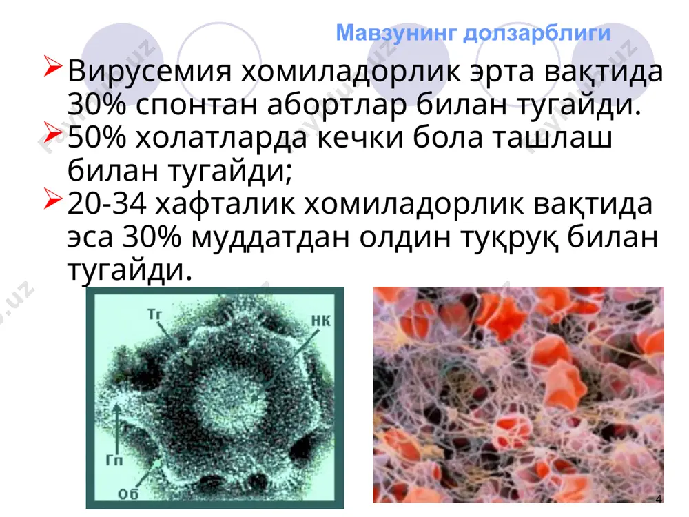 ан иборат). сульфадимезин 150 мг/кг/сут. кунига 4 махал. ичишга. 1 ой. пириметамин (хлоридин) 1 мг/кг/сут. кунига 2 махал ичишга. 1 ой. 2-3 кун тўйинтирувчи доза 2 мг/кг/сут. фолий кислота 5-10 мг/кг/сут. ичишга (қон хосил қилувчи органлар томонидан токсик реакцияни олдини олиш мақсадида). қизилча togaviridae оиласига, rudivirus родига кирувчи рнк сақловчи вирус томонидан чақирилади. хомиланинг инфицирланиш хавфи онанинг инфицирланган вақтига боғлиқ. биринчи 12 хафталик хомиладорлик вақтида инфицирланиш бўлса, хомиладорликни тўхтатиш керак. қизилча юқиш йўли – хаво томчи орқали. хомиладорларда трансплацентар. иммунитет- турғун бутун умрга. қизилча билан инфицирланиш хомиладорликни 3-4-хафтасида 60% холатларда, 9-12-хафталикда 15% ни ва 13-16-хафталикда— 7% ида туғма аномалиялар учрайди. клиника грега классик триадаси : туғма юрак нуқсони (очиқ артериал йўлак, ўпка артерияси стенози, қатн ва батн); кўзнинг зарарланиши (глаукома, катаракта, хориоретинит); эшитиш органи ривожланиш нуқсони(эшитиш нервининг зарарланиши) бундан ташқари хомила ичи ривожланишининг орқада қолиши, жигар функциясининг бузилиши, анемия, тромбоцитопения, мнс шикастланиши, иммунодефицит холатлар ва тишлар дисплазияси кузатилиши мумкин. “blueberry …