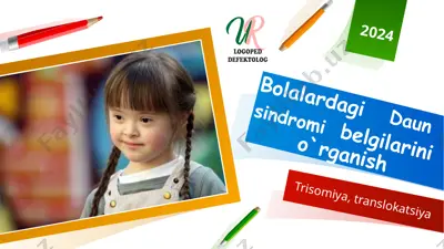bolalardagi daun sindromi belgilarini o`rganish — PPT