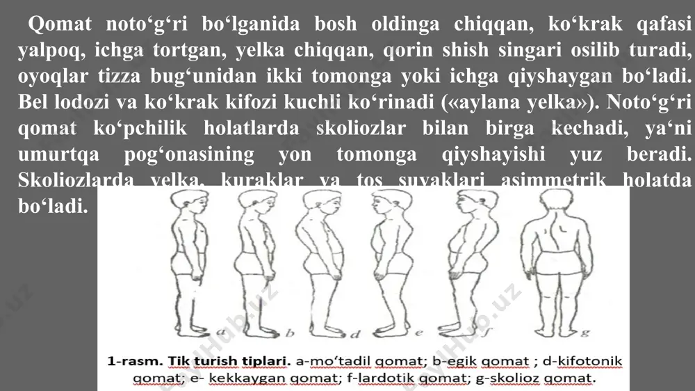 ushbu harakat aktiga aloqasi bo‘lmagan ko‘plab muskullar qisqaradi. buning natijasida tormozlanish rivojlanadi, muskullarning ish bajarish qobiliyati pasayadi. sport bilan shug‘ullanuvchi odamlarda yurak muskullarining qisqarish soni kamayadi, lekin sistolik va minutlik qon haydash hajmi ortadi. sport bilan shug‘ullanmagan odamlarda esa yurakning minutlik hajmi uncha jiddiy bo‘lmagan sistolik hajmini ortishi va yurak faoliyatini jiddiy tezlashishi hisobiga yuz beradi. 7 4-5yoshgacha bo‘lgan bolalalarni katta odamlar uzoq vaqt qo‘lidan yetaklab yurmasligi kerak, chunki bolaning bir tomoni yuqoriga ko‘tarilishi tufayli umurtqa pog‘onasi egrilanib qolishi mumkin. bolaning 6-7 yoshdan qad-qomati shakllana boshlaydi. shuning uchun boshlang‘ich sinf o‘quvchilari uzoq vaqt bir joyda o‘tirmasligi, tik turmasligi, uzoq masofaga yurmasligi, og‘ir buyumlarni ko‘tarmasligi, ayniqsa doim faqat bir qo‘lida ish bajarmasligi, bo‘ylariga mos parta, stol-stullarda o‘tirishi kerak. o‘quvchilar parta, stol-stulda o‘tirganda quyidagi qoidalarga rioya qilishi zarur: o‘tirganda gavdasi tik, yelkalari bir tekisda, beli stul (parta) suyang‘ichiga suyanib tursin, oyoqlari tizza bo‘g‘imida to‘g‘ri burchak hosil qilib bukilsin, oyoq kaftining hamma yuzasi …