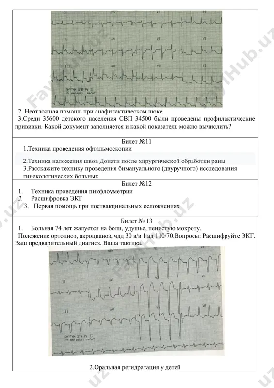 копии 2.техника наложения швов донати после хирургической обработки раны 3.расскажите технику проведения бимануального (двуручного) исследования гинекологических больных билет №12 1. техника проведения пикфлоуметрии 2. расшифровка экг 3. первая помощь при поствакцинальных осложнениях билет № 13 1. больная 74 лет жалуется на боли, удушье, пенистую мокроту. положение ортопноэ, акроцианоз, чдд 30 в/в 1 ад 110/70.вопросы: расшифруйте экг. ваш предварительный диагноз. ваша тактика. 2.оральная регидратация у детей 3.больной, проживающий на участке сп№ 18 вызвал скорую помощь. больному был поставлен диагноз пищевое отравление. тактика врача ? билет № 14 1. больной 65 лет жалуется на приступы сердцебиения, возникающие 1-2 раза в месяц, длительностью до 1-2 ч; купируются самостоятельно. в этот раз приступ затянулся до 4 ч. вопросы: расшифруйте экг. ваш диагноз. ваша тактика. 2.как называется ф-90-/у и кем заполняется? 3. осмотр шейки матки в зеркалах билет №15 1. больной 64 лет жалуется на приступ учащенного сердцебиения, резкую общую слабость. кожные покровы бледные, акроцианоз …