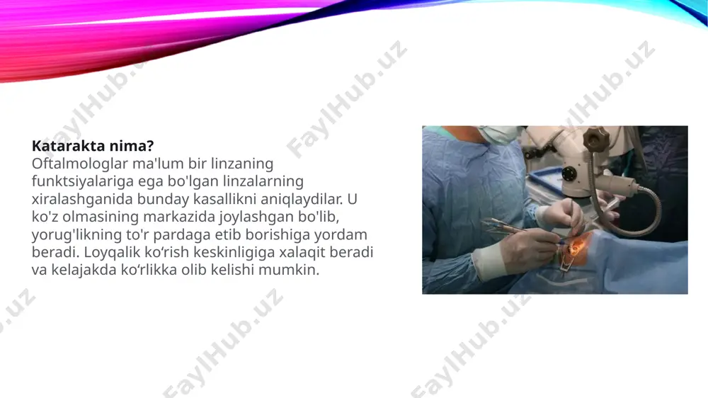 da ekanligini aniqlash kerak. jarrohlik boshqa muolajalar qo'llanilmaguncha kechiktirilishi mumkin. kasallik turli yo'llar bilan rivojlanishi mumkin. ba'zilar uchun terapevtik davolash linzalarning xiralashishini to'xtatish uchun etarli bo'lishi mumkin, boshqalari uchun esa imkon qadar tezroq operatsiya qilinadi. katarakta rivojlanishining to'rt bosqichi mavjud: dastlabki, ob'ektiv uzoq joylarda bulutli bo'lganda. bemor bezovtalikni boshdan kechirmaydi, kasallikni sezmaydi, ko'rishning biroz pasayishi, ba'zida ikki tomonlama ko'rish kuzatiladi. agar terapiya shu bosqichda boshlangan bo'lsa, ikkinchi bosqichga o'tish 10-20 yil davom etishi yoki umuman bo'lmasligi mumkin. ishga etmagan katarakta ko'rishning sezilarli darajada yomonlashishi bilan tavsiflanadi. ob'ektiv bir hil bo'lib qoladi va ko'z ichidagi bosim glaukomaga, keyin esa optik asab atrofiyasiga olib keladi. ushbu bosqichda katarakt jarrohligi eng samarali davolash usuli hisoblanadi. etuk katarakta ko'rishning yomonligi bilan namoyon bo'ladi, agar odam allaqachon konturlarni ko'rishda qiynalsa va ranglarni zo'rg'a ajratsa. bunday holda, ko'rish qobiliyatini tiklash uchun katarakta operatsiyasini imkon qadar tezroq bajarish kerak. organilgan (morganiyev) katarakta linzalarning to'liq parchalanishi bilan tavsiflanadi, …
