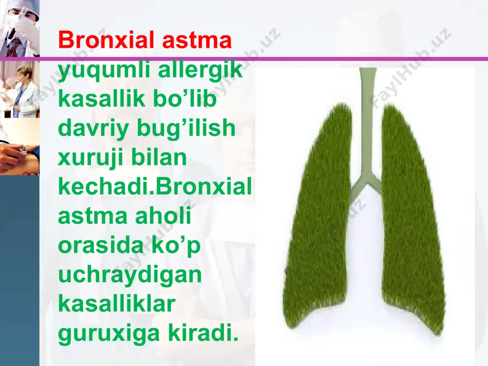i, shilliq tiqin, silliq mushaklar giperplaziyasi, bazal membrana qalinlashishi va dezorganizasiyasi aniqlanadi. bronxial astmada endobronxial biopsiyada bronx epiteliysining ko’chishi, shilliq qavat eozinofil infiltrasiyasi ko`riladi. bronxlar yuvindi suvida ko`p miqdorda epitelial, semiz xujayralar, eozinofillar va limfositlar topiladi. www.themegallery.com klinikasi: www.themegallery.com shikoyatlar va anamnez ekspirator xansirash va/yoki yo`tal xurujlari masofadan xushtaksimon xirillashlar eshitilishi ko`krak qafasida og`irlik xissi ob’ektiv ekspirator xansirash burun kataklarini nafas olganda kengayishi quzg`alish nafas aktida qo`shimcha mushaklar ishtiroki majburiy xolat perkussiyada: emfizema shakllanganda qutisimon perkutor tovush auskultasiyada: qurug` xushtaksimon va g`o`ngillovchi xirillashlar xamda nafas chiqarish fazasining uzayishi bronxial astmaning tasnifi asosiy patogenetik variantlari g.b.fedoseev tomonidan to’ldirilgan tasnif bo’yicha: www.themegallery.com infeksion-bog`liq atopik autoimmun disgormonal disovarial asabiy-ruxiy adrenergik disbalans xolinergik jismoniy zo`rig`ishdagi astma aspirin astmasi (triada) bronxial astmaning kechish darajalari: www.themegallery.com engil kechishi-yilida 2-3 marta xuruj o`rtacha og`irlikda kechishi-yilida 3-4 marta xuruj-shifoxonada davolanib yuradi. og`ir kechishi-xuruj tez-tez yilida 5 martadan ko’p kuzatiladi. davolash : bemor organizmiga allergenlar ta’sirini kamaytirish. bo’g’ilish xurujlarini …