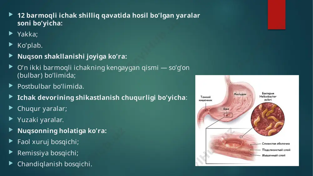 umiy qon va siydik tahlillari; najasni tahlil qilish; biokimyoviy qon tahlili; oshqozon shirasi tahlillari — nordonlik darajasini aniqlash uchun. instrumental tadqiqotlar: fegds o’tkaziladi — bu tekshiruv shifokorga oshqozon va o’n ikki barmoqli icha shilliq qavatining holatini baholashga, gistologik jihatdan o’rganish uchun u yerdan namuna olishga imkon beradi. qorin bo’shlig’ining ultratovush tekshiruvi. o’n ikki barmoqli ichak yarasini davolash mazkur kasallikni davolash uzoq davom etadi, bemor butun hayoti davomida parhezga amal qilishi kerak bo’ladi. garchi hammasi o’ta ayanchli emas — shifokorlar parhez to’lqinsimon bo’lishi mumkinligidan ogohlantiradilar: kasallikning xuruji davrida oziq-ovqat maksimal darajada chegaralangan va eng avaylovchi bo’ladi, uzoq muddatli remissiya davrida esa istalgan, hatto zararli oziq-ovqatlarni iste’mol qilishga ham ruxsat beriladi. ichak yarasi bo’lganda parhez qoidalari o’n ikki barmoqli ichak yarasi bo’lganda, bemor qaysi mahsulotlar oshqozonda xlorid kislota konsentratsiyasini ko’paytirishini bilishi kerak: gazlangan va alkogolli ichimliklar; achchiq va booshqa ziravorlar va har qanday, hatto juda mazali, souslar; qovurilgan ovqatlar (hatto sabzavot va …