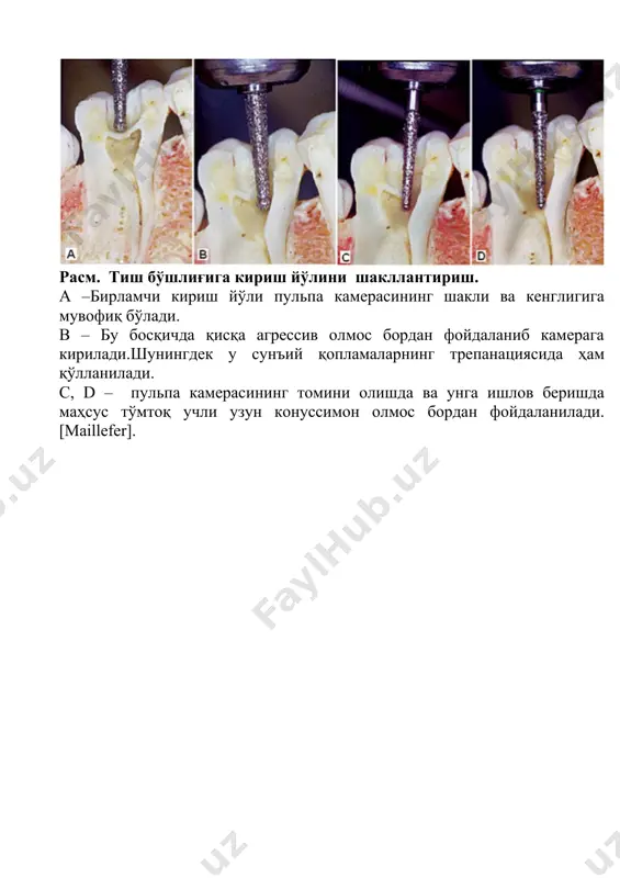 олиб ташлаш мумкин.зонд-илмоқ ёрдамида дентиннинг тўғри олиб ташланганлигини текшириш мумкин. илдиз каналлари тешигига ингичка зонд ёрдамида кирилади.зонд ёриққа илинганда 15-ўлчамдаги н -файл ёрдамида канал тешиги ёки перфорация эканлиги текширилади.. расм. илдиз каналлари “оғзи”ни зондлаш. чапда:энг муҳим илдиз канали “оғзи”га ўтувчи асбоблар узун ва чидамли зондлар ҳисобланади.ўртада: ручные инструменилдиз каналлари тешигини зондлаш учун қўл асбоблар.ўнгда: бўшлиқ туби юмшоқ тўқимасини олиб ташлаш учун экскаваторлар. 10-мавзу илдиз канали ишчи узунлигини аниылаш усуллари. клинистлар учун канал ишчи узунлигини билиш жуда муҳимдир.ишчи узунликни математик,рентгенограммада,асбоб ёрдамида тактил ёки электрон асбоблар ёрдамида аниқлаш мумкин.шунингдек илдиз каналини қуритишда қоғоз штифтдаги қон ёки экссудат ишчи узунликни аниқлашга ёрдам бериши мумкин.штифт учидаги қон апикал ёриқнинг ҳаддан ташқари кенгайганлигини ва асбобнинг илдиз чўққисидан чиққанлигига гувоҳлик беради,бу ватда штифтнинг ён юзасидаги қон латерал перфорация борлигидан далолат беради. расм.илдиз ишчи узунлигини конуссимон қоғоз штифт ёрдамида аниқлаш расм.ўлчовни коррекциялаш.илдиз узунлигини белгилашда ишлатиладиган асбоблар. тепадан чапда: guldener ўлчов блоги. пастда — бармоққа тақладиган линейка(maillcfer), ўнгда: …