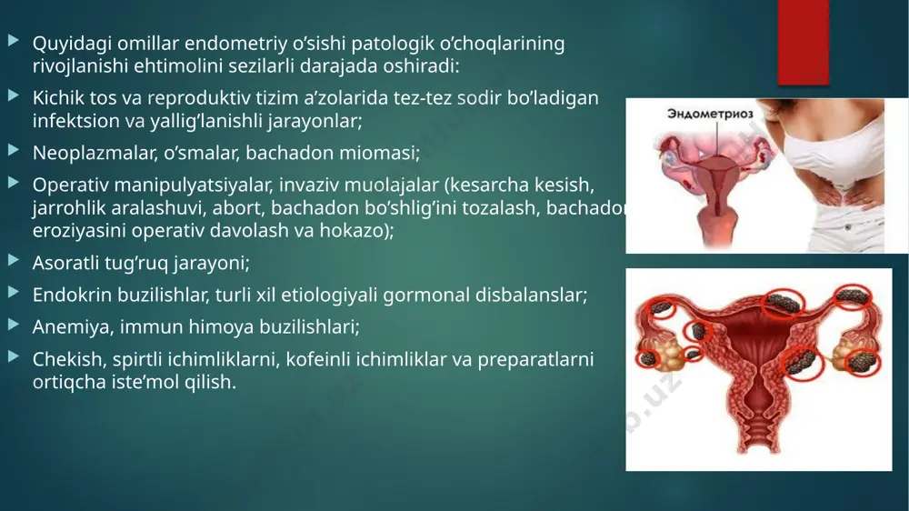 a endometriy hujayralarning transportirovkasi, endometriozning boshqa o’choqlaridan hujayralarning chiqishi, shuningdek homilaning rivojlanish davridagi anomaliyalari bilan bog’liq. peritoneal endometriozdagi alomatlar ham tos hududidagi og’riq hissi bilan namoyon bo’ladi, og’riq jinsiy aloqa, defakatsiya, hayz vaqtida paydo bo’ladi yoki kuchayadi. kasallikning ushbu shaklini tashxislash juda qiyin, ko’pincha peritoneal endometrioz o’choqlari terapevtik yoki diagnostik operatsiya vaqtida aniqlanadi. qin endometriozining sabablari va belgilari bachadon endometriozi nafaqat a’zoning bo’yiniga, balki qinga ham tarqalishi mumkin, ayniqsa, qinda yallig’lanish jarayonlari, yaralar, yuzaning yaxlitligini buzgan jarohatlar mavjud bo’lsa. kasallikning klinik ko’rinishi jinsiy aloqada qon ketish va og’riqli his-tuyg’ular, hayz kelishida og’riqning qinda joylashishidir. tashxislash bemorlarni ginekologik tekshiruvdan o’tkazish va tadqiq qilish uchun materiallar olish orqali amalga oshiriladi. terapiya usuli — medikamentoz davolash, gormonal preparatlarni tayinlash, dorivor preparatlardan samara bo’lmagan holda, olib tashlash, kuydirish uchun jarrohlik muolajalari o’tkazishdir qovuq endometriozi xususiyatlari qovuq (siydik pufagi) devorlarining endometriy bilan shikastlanishi kamdan-kam hollarda kuzatiladi. kasallikning ushbu shakli rivojanishining sabablari orasida hayz paytida qonning …