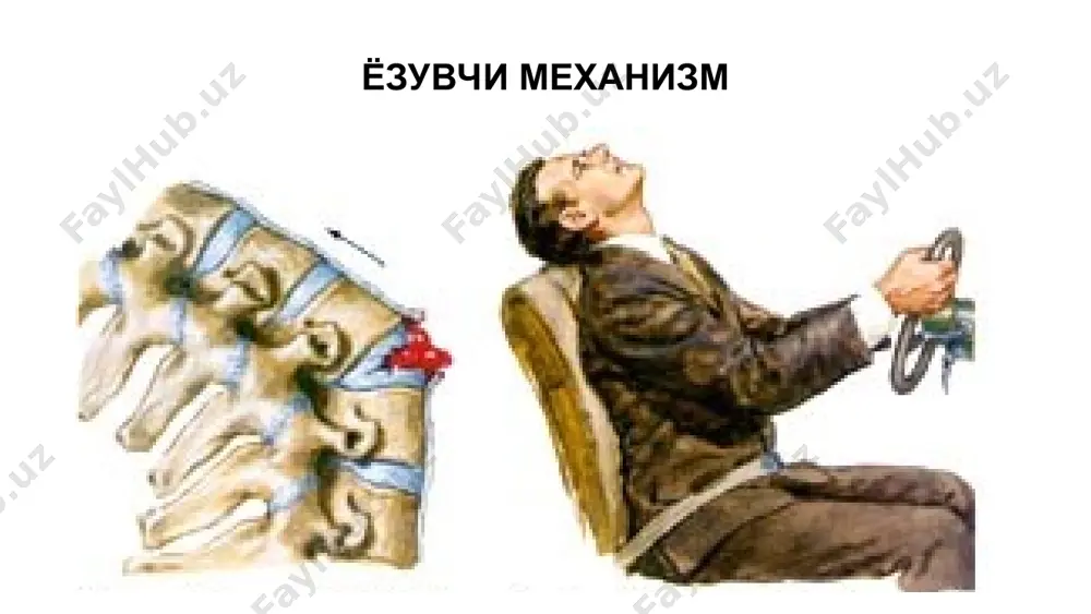 умуртқа жарохатлари - Page 5