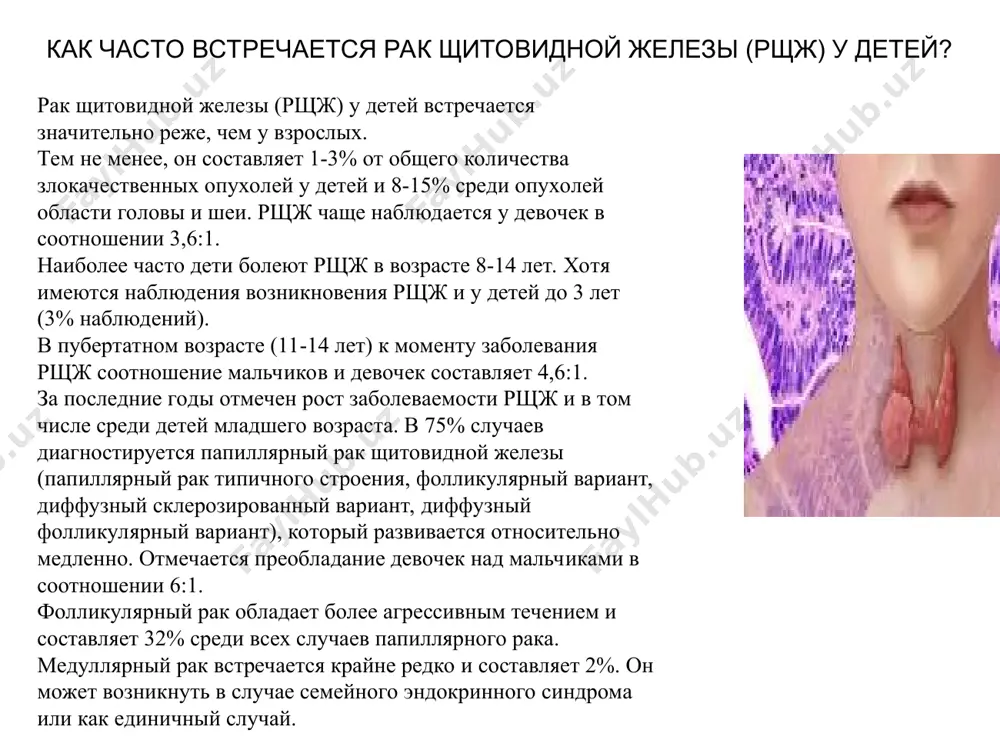 й группы лимфатических узлов выявляется почти у 100% больных. отдаленные метастазы в легких и костях обнаруживаются у 20% детей с рщж. иногда поражение легких является случайной находкой при обследовании ребенка по поводу простудных заболеваний. особый интерес представляют дети с так называемым скрытым рщж, когда имеется небольшая опухоль, не выявляемая доступными методами исследований, и первым клиническим признаком служат увеличенные шейные лимфатические узлы. в таких ситуациях необходимо знать, что причиной увеличения лимфатических узлов может быть рщж. от появления первых симптомов заболевания до установления диагноза рщж проходит от 1 месяца до 2,5 лет. у 50% больных удается уточнить диагноз спустя 1,5-2 года. у 15-20% детей с увеличенными шейными лимфатическими узлами ставится диагноз хронического тонзиллита и назначается физиотерапия. скрытый (латентный) период от момента воздействия неблагоприятного фактора и развитием рщж в среднем составляет 5-10 лет, но может быть удлинен до 35-40 лет. диагностика рака щитовидной железы важными моментами диагностики рщж является осмотр и ощупывание (пальпация) …
